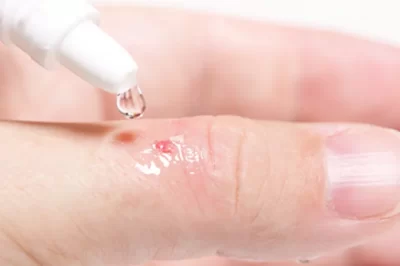 医用级氰基丙烯酸酯强力胶完整指南