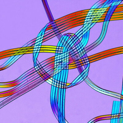 弹性纤维和氨纶的区别是什么？