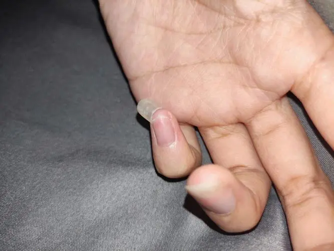 我可以用胶水修复断掉的指甲吗？