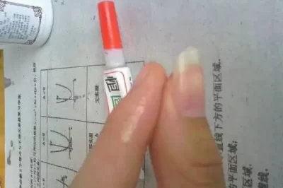 为什么超级胶粘剂会粘在皮肤上？