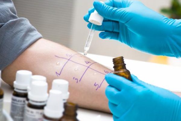 对硅胶过敏反应的迹象是什么？