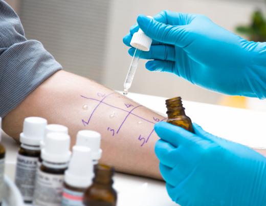 skin-allergy-testing