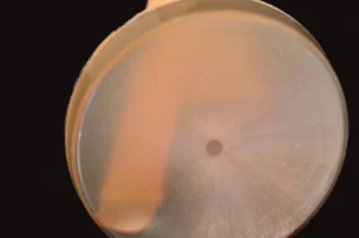 为什么我的树脂变黄了？