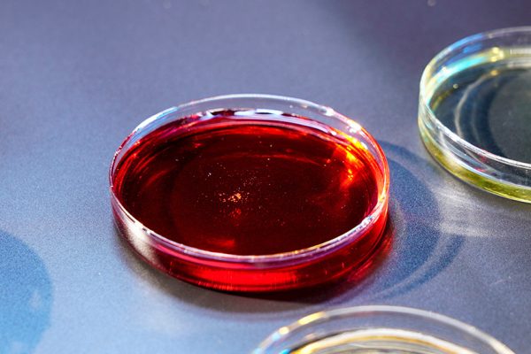 最常用的复合材料树脂类型